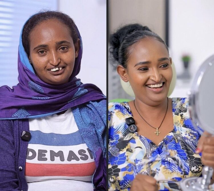 ሁለቱም የ1 ሰው ፎቶ ነው የሚገርም ለው!!