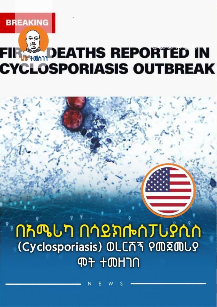 በአሜሪካ በሳይክሎስፖሪያሲስ (Cyclosporiasis) ወረርሽኝ የመጀመሪያ ሞት ተመዘገበ